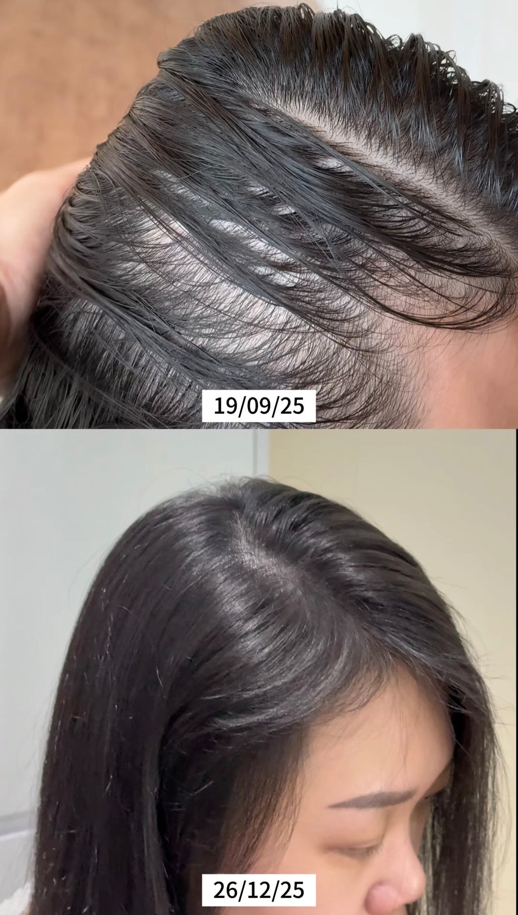 Hair Dore ACTRIBOOST  Actri 黑仙素