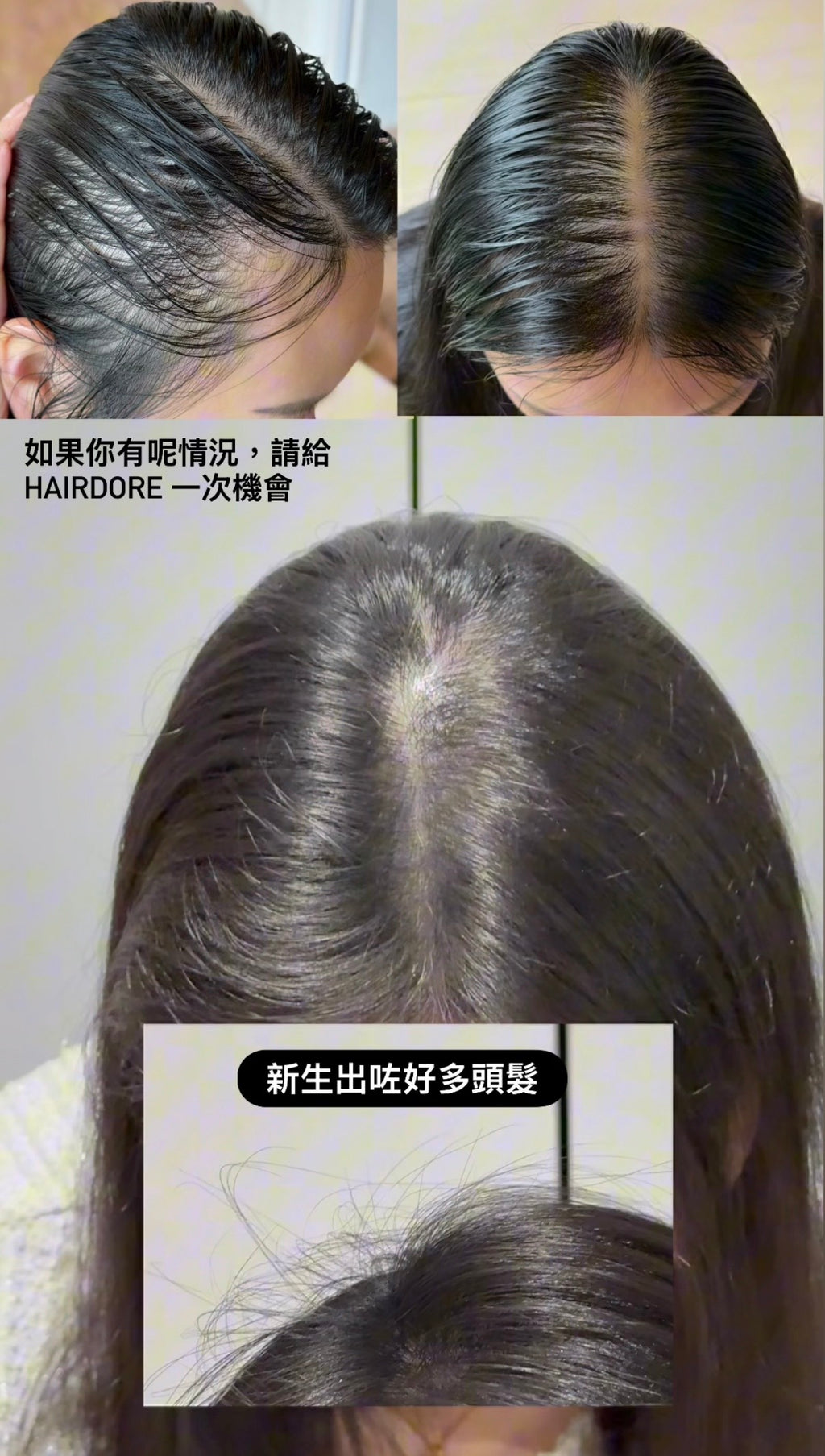 Hair Dore Special HK988 Bundle