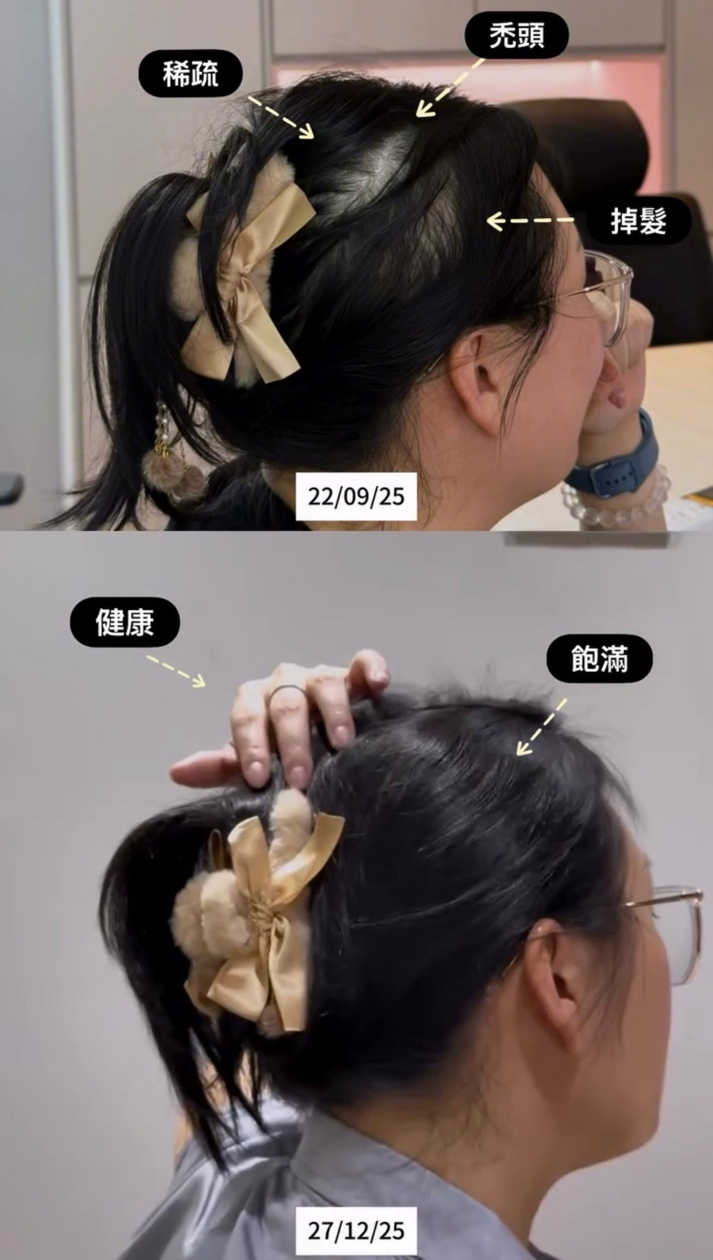 Hair Dore Special HK988 Bundle