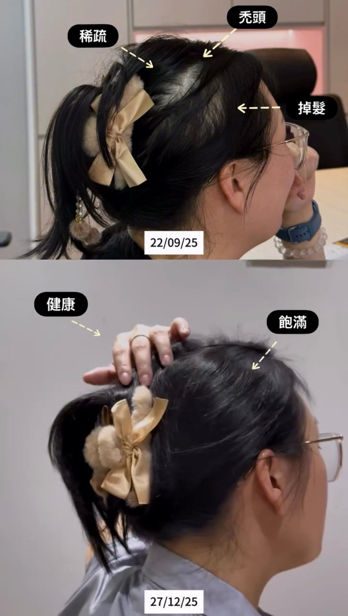 Hair Dore 胜肽豐盈水潤洗髮露 Pepti HydraShine Shampoo 400ML