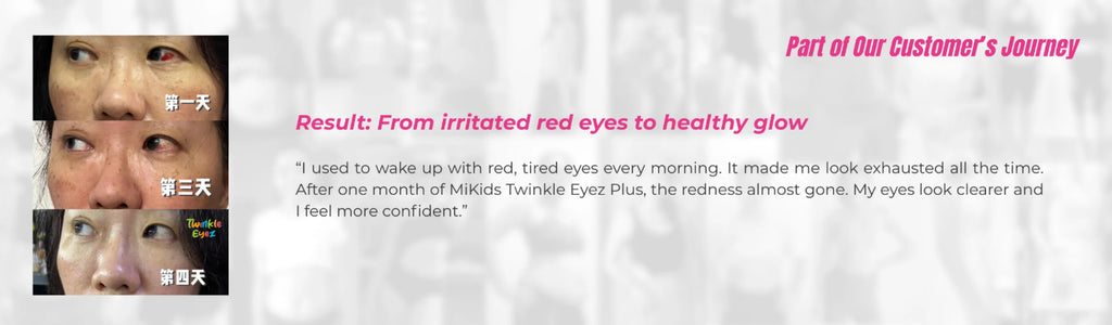 MiKids Twinkle Eyez Plus 護眼粉 Powder 2g/ 1 sachet