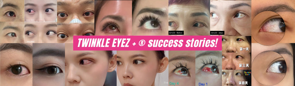 MiKids Twinkle Eyez Plus 護眼粉 Powder 2g/ 1 sachet