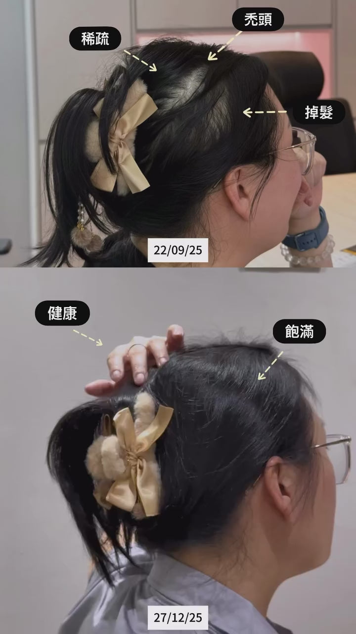Hair Dore ACTRIBOOST  Actri 黑仙素